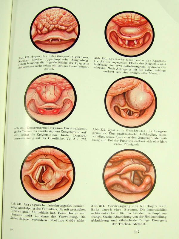 WWII German Medical Book Atlas Ear Nose Throat Diseases